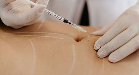 Elimina Grasa Localizada