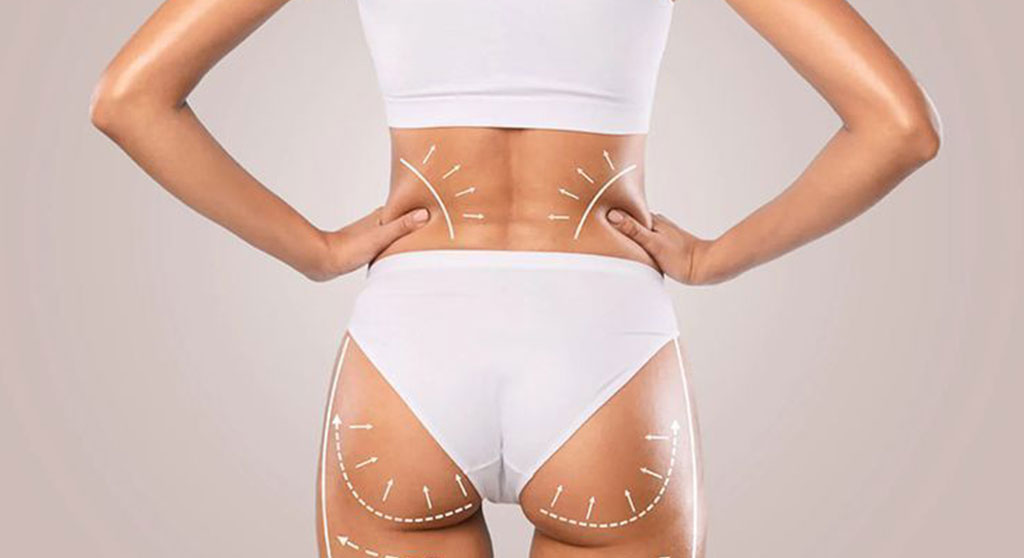 Glúteos Elevados y Firmes